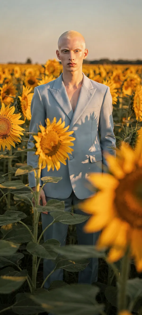 Albino Model Sunflower Portrait